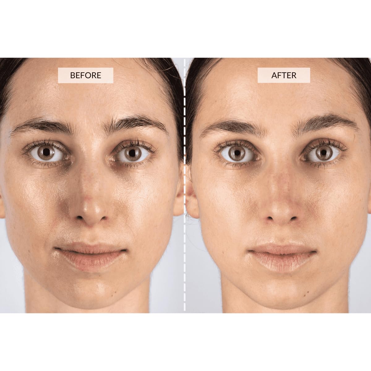 CurrentBody Skin LED Light Therapy Face Mask: Series 1 | Red Light Therapy Treatment Device | Anti-Aging Face Mask for Wrinkle Reduction