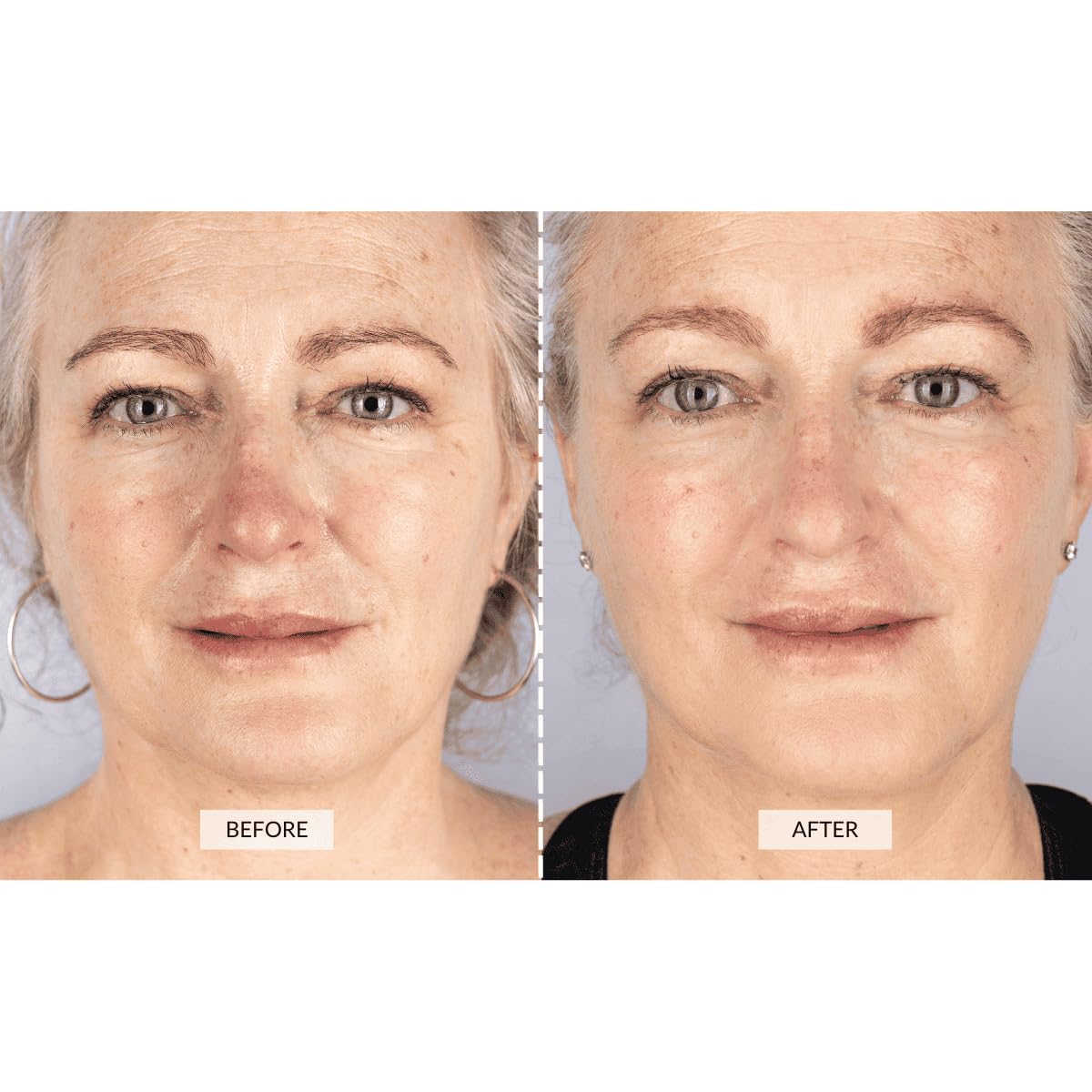 CurrentBody Skin LED Light Therapy Face Mask: Series 1 | Red Light Therapy Treatment Device | Anti-Aging Face Mask for Wrinkle Reduction