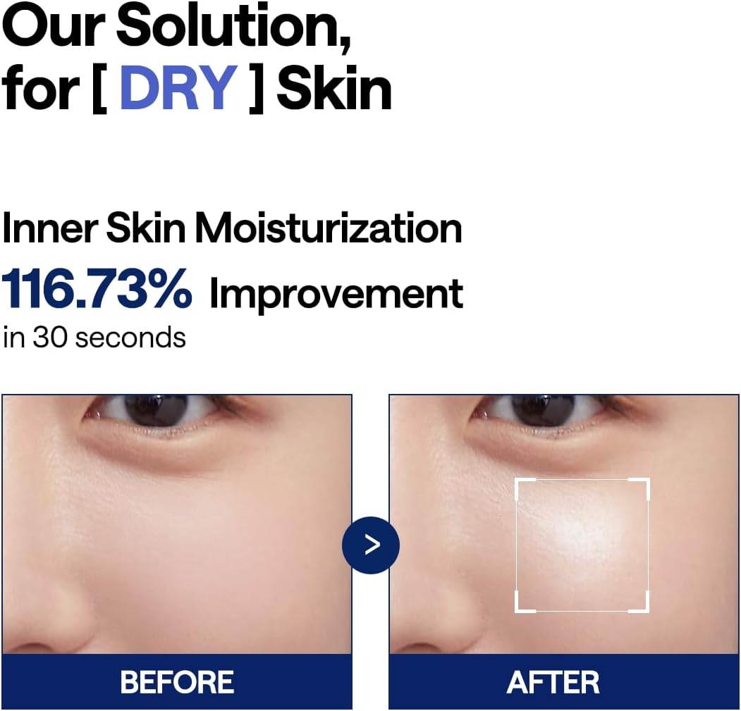MEDIHEAL Watermide Toner Pad - vierkante katoenen gezichtstonerpads met Icelandic Glaciaal Water - Verbetert de huidtemperatuur, hydraterende tonerpads om te drogen, puffy, zachte huid - veganistische