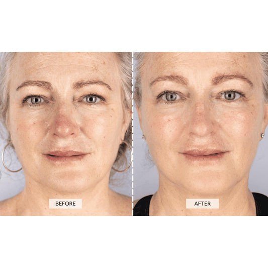 CurrentBody Skin LED Light Therapy Face Mask: Series 1 | Red Light Therapy Treatment Device | Anti-Aging Face Mask for Wrinkle Reduction