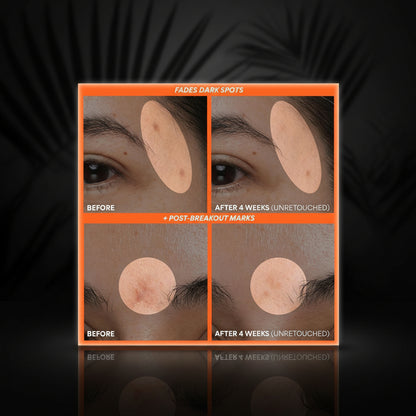 innisfree Green Tea Enzyme Vitamin C Serum for Dark Spot Fading, Korean Face Serum for Glow and Radiance